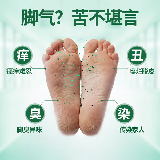 Chunchuntang Yunnan Herbal Athlete's Foot Spray Anti-itching Peeling Feet Odor Sweat Fungal Infection Blister Foot Medicinal Pack Yalan Antibacterial Cream