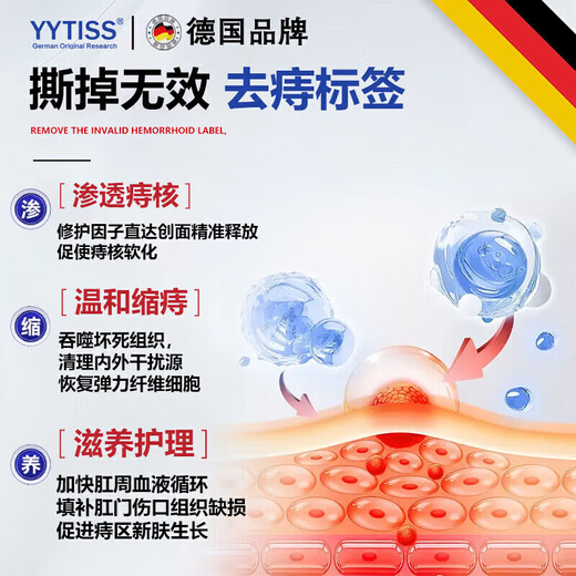 YYTISS hemorrhoid cream medical carbomer hemorrhoid gel special removal of flesh balls and roots hemorrhoid cream mole Cang genuine anal itching