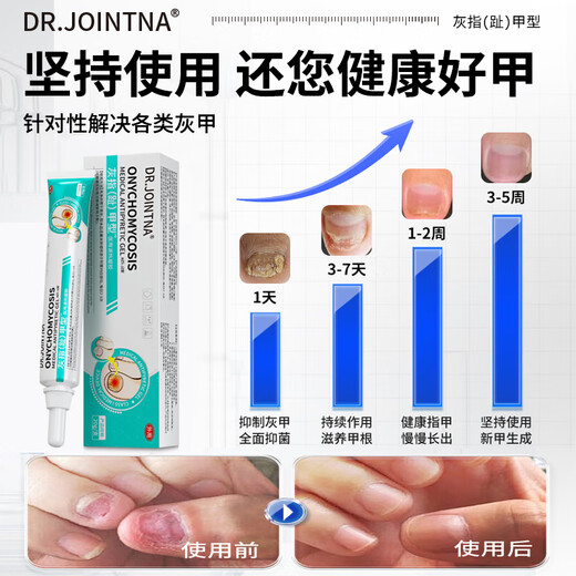 DR.JOINTNA Pharmaceutical onychomycosis special nail fungal infection denaturation and bad nail yellowing and thickening special effect nail artifact liquid phoenix flower