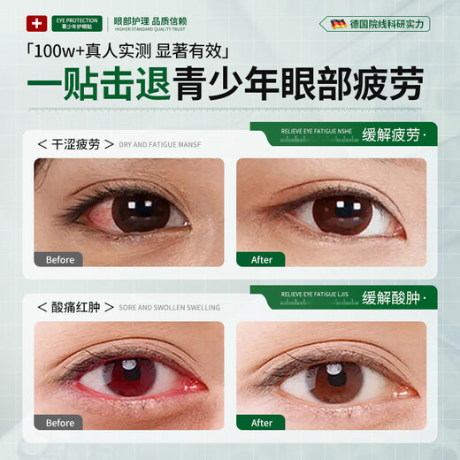 BEAI Lutein Youth Eye Protection Patch Children's cold compress relieves eye fatigue, non-myopia, astigmatism, dryness and moisturizing of eyes