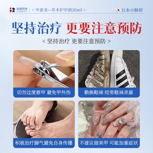 Xizi onychomycosis special effect root cream is specially used to treat nail fungal infection, remove the nail, make it yellow, thicken and thicken the antibacterial liquid.