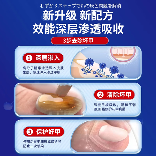 Higashida Japanese onychomycosis 100% genuine special fungal infection onychomycosis thickening, yellowing, thickening and empty 2 boxes suitable for moderate onychomycosis