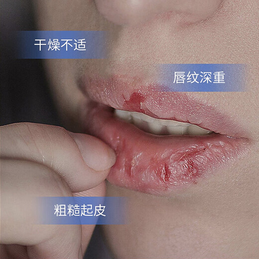 
Men's moisturizing lip balm Lip care Autumn and winter moisturizing lip balm 2.7g/pin 2