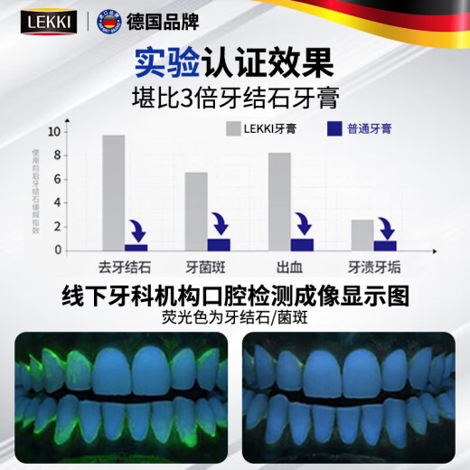 Sunoyar去牙结石牙膏口臭去黄去牙渍去烟渍牙垢清除牙结石溶解液护龈固齿
