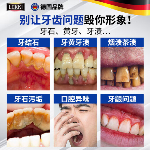 Sunoyar去牙结石牙膏口臭去黄去牙渍去烟渍牙垢清除牙结石溶解液护龈固齿
