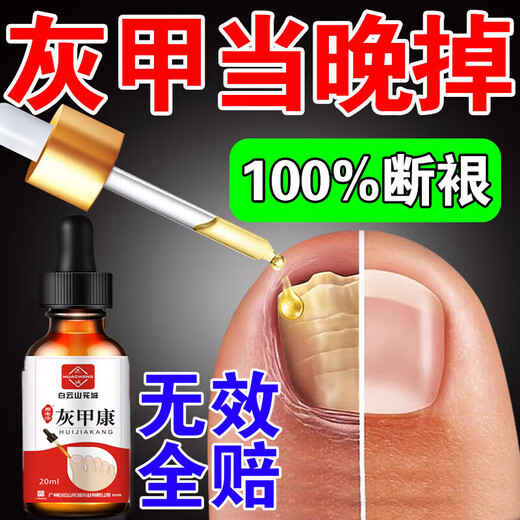 Baiyunshan Huacheng Onychomycosis 100% special effect medicine for nail fungal infection, removal of onychomycosis, thickening of onychomycosis, antibacterial potion, special effect 3 boxes, 90% selection, 2 get 1 free