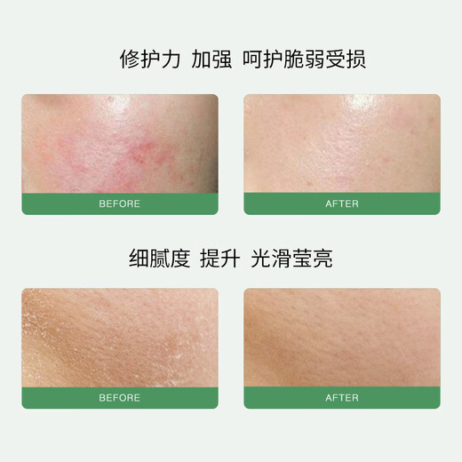 佳雪（CATHY）【官方正品】雅倩芦荟保湿霜国货补水保湿芦荟胶保湿男士面霜护肤 高度
