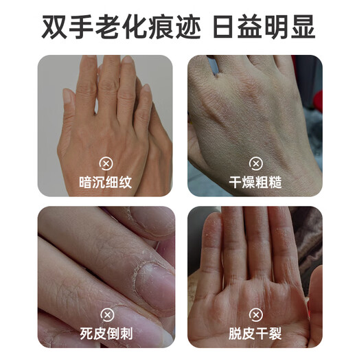 TWG栀子花维e尿素护手霜夏季专用清爽防干燥粗糙淡化细纹男女士专用