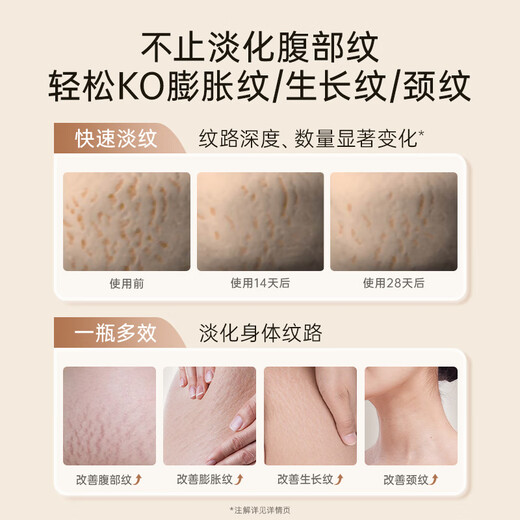 
Kangaroo mother expectant pregnant women pregnancy oil milk double extraction small gold bottle stroke essence milk special olive oil for postpartum repair and desalination of lines