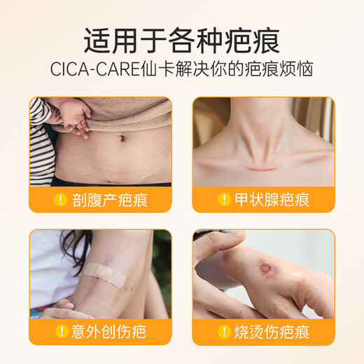 Xianka medical caesarean section hyperplasia burn and scald medical beauty scar removal patch self-adhesive silicone film dressing 12cm*3cm