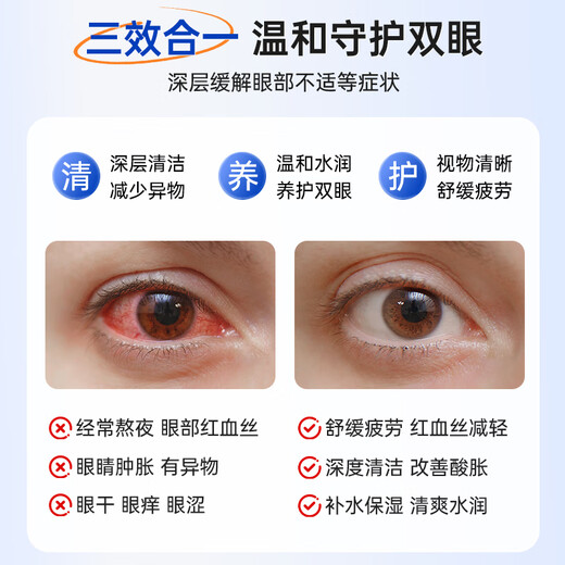 FIT MOMENT Lutein Eye Drops Non-Eye Drops Relieve Fatigue Dry Eyes Blurred Vision Healthy Solution for Staying Up Late and Playing with Mobile Phones