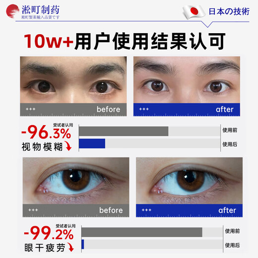 
Songcheng Pharmaceutical Lutein Eye Protection Spray Water Eye Wash Relieve Fatigue Itching Dry Vision Blur Foreign Eye Protection Tool