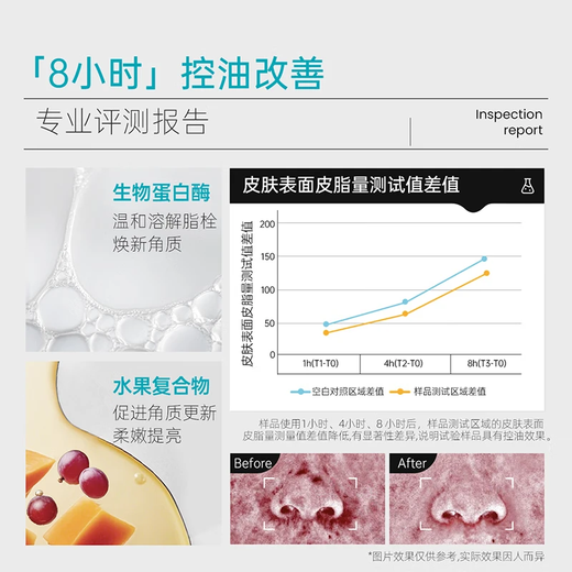 ILSO黑头导出精华液黑头水去粉刺白头闭口深层清洁控油平衡试用装1片