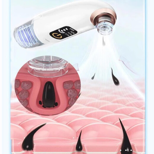 DIKTT Germany blackhead suction instrument cleaner for beauty salons, dedicated for home use with large suction power, electric small bubbles, pore cleaning and hydration, sucking out acne and facial blackhead cleaning artifact. Upgraded vacuum negative pressure deep cleansing, painless and does not hurt the skin. Fully equipped / 80 million negative ions + 4-level adjustment + longer lasting