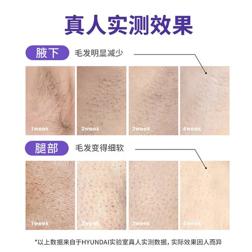 HYUNDAI Sapphire Ice Gratitude Legs Lips Armpit Hair Private Parts Bikini Full Body Hair Removal Instrument Light Spot 520 Valentine's Day Gift Medical Standard - Sapphire Promax Version More Ice