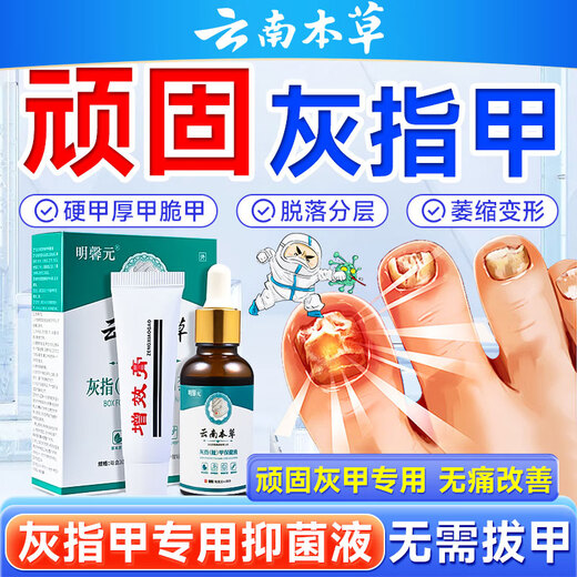 Yunnan Herbal Impatiens for Onychomycosis Antibacterial Onychomycosis Liquid Thickening, Yellowing and Empty Onychomycosis Special Effect Kit