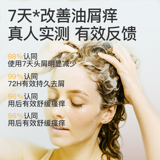Sakose Selen-Disulfid Aminosäure Anti-Dandruff-Kontrolle Shampoo 300 ml Anti-Champoo Shampoo Shampoo Lotion für Männer und Frauen