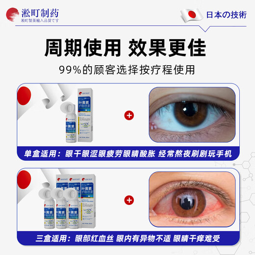 
Songcheng Pharmaceutical Lutein Eye Protection Spray Water Eye Wash Relieve Fatigue Itching Dry Vision Blur Foreign Eye Protection Tool