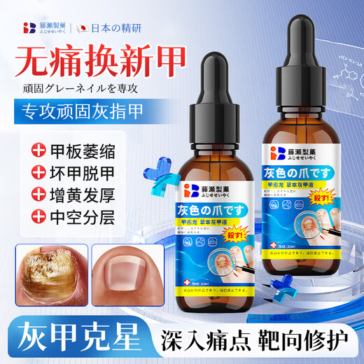 Xizi onychomycosis special effect root cream is specially used to treat nail fungal infection, remove the nail, make it yellow, thicken and thicken the antibacterial liquid.