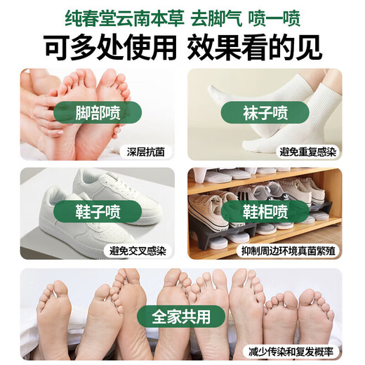 Chunchuntang Yunnan Herbal Athlete's Foot Spray Anti-itching Peeling Feet Odor Sweat Fungal Infection Blister Foot Medicinal Pack Yalan Antibacterial Cream