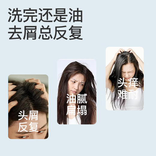 Sakose Selen-Disulfid Aminosäure Anti-Dandruff-Kontrolle Shampoo 300 ml Anti-Champoo Shampoo Shampoo Lotion für Männer und Frauen