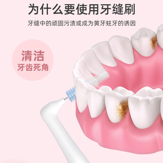 Xiaolu Mama fine tooth interdental cleaning brush imported super fine ssss*20 pack L-shaped interdental brush directly attacks deep-seated tartar