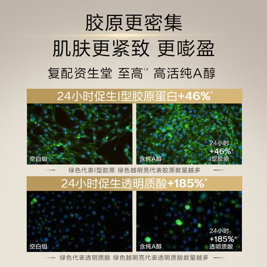 Shiseido (SHISEIDO) second generation Yuewei Zhisen small needle anti-wrinkle eye cream 20ml full face light wrinkle skin care product birthday gift box