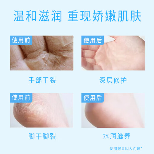 Sakose Vaseline moisturizing and repairing foot mask 3 pairs + hand mask 3 pairs 40g/pair hand cream to remove dead skin and whiten feet