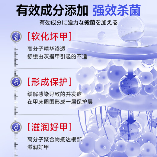 Jianbu Pharmaceutical onychomycosis special for severe nail fungal infection, removal of onychomycosis, thickening and yellowing health care solution 30ml