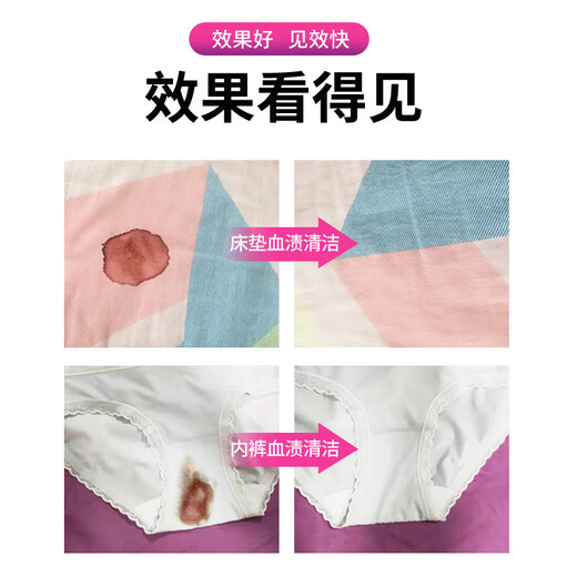 Kewang underwear blood stain removal cleaning agent 500ml to remove blood stains and remove yellow underwear special laundry detergent bed sheet mattress dry cleaning