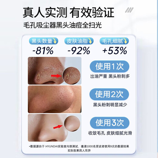 HYUNDAI Korean small bubble blackhead suction device, electric large suction beauty salon, special blackhead suction device for men and women, cleaning artifact, New Year's Day holiday gift for male and female friends, gift bag type - oxygenated water circulation - replenishing water while sucking - sparkling water