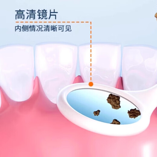 DIKTT German dental scaler ultrasonic cleaning tooth calculus remover smoke stain removal artifact household electric dental scaler teeth cleaning dirt removal tartar gift for the elderly parents and boyfriends Yuanshan Blue - 5-speed adjustment - high frequency ultrasonic - free full set of teeth cleaning gifts easy to use + tooth cleaning gravel does not hurt the teeth