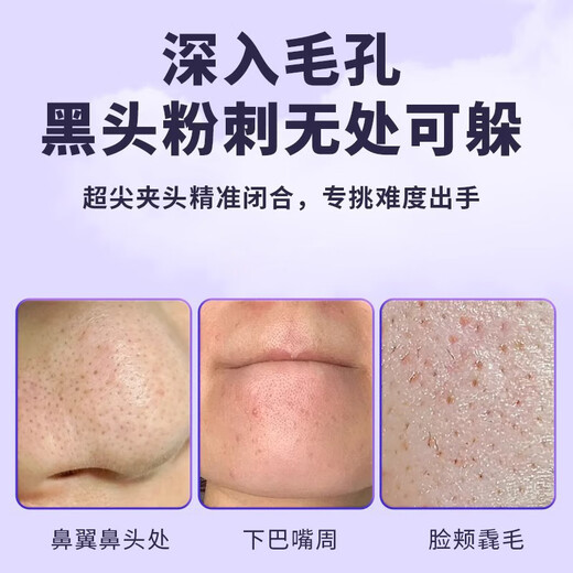 Ye Feili two-piece set ultra-sharp dolphin clip cell clip acne needle eyelash tweezers blackhead and acne cleaning acne picking needle