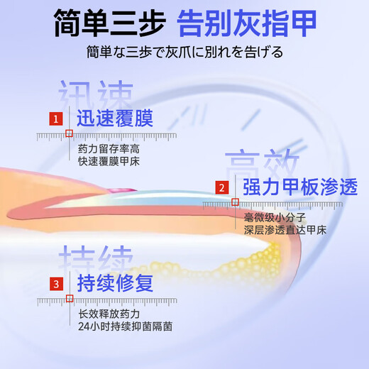 Jianbu Pharmaceutical onychomycosis special for severe nail fungal infection, removal of onychomycosis, thickening and yellowing health care solution 30ml