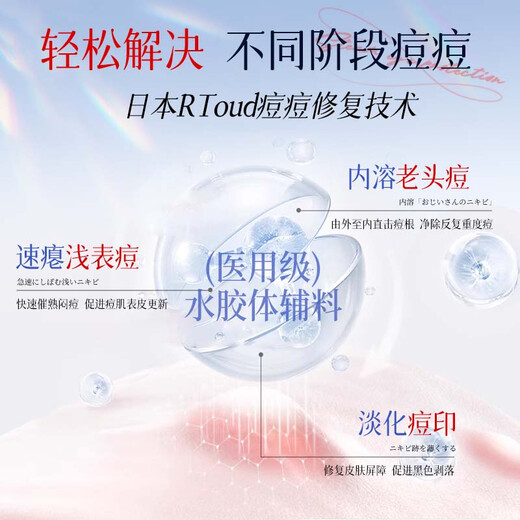 Jiubu Pharmaceutical Medical Acne Patch eliminates pus inflammation, invisible, thin, acne-removing artificial skin, repairs and fades concealer patch 108 patches/box