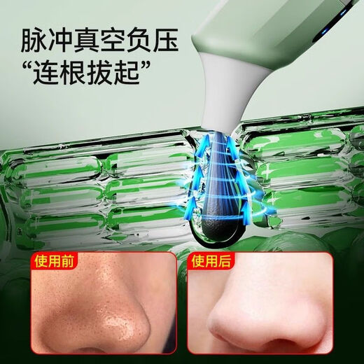 KONKA visual blackhead absorbing instrument cleaner electric blackhead instrument facial pore cleaning acne home beauty instrument tail cargo machine recommended theater same style mobile APP visual cleaning set