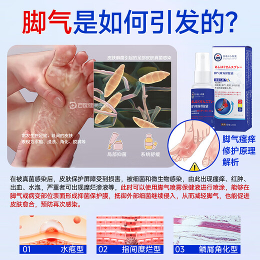 Athlete's foot spray to relieve itching, peeling and rotten feet, fungal infection, deodorizing and root removal, special treatment for smelly and sweaty feet, 3 boxes