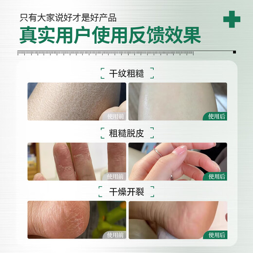 BEAUTY NOTES Horse Oil Anti-Crack Cream Vaseline Cracked Hands, Feet, Cracked Heels, Moisturizing Body Lotion, Hand Cream 380g