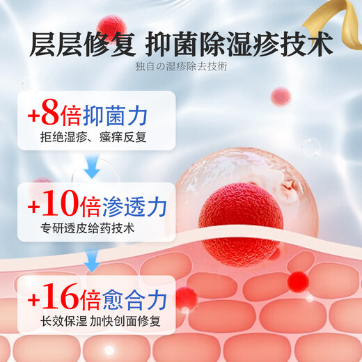 ASHK eczema plaster skin itching erythema antipruritic cream fungal infection sweat herpes anal itching 20g*3 box