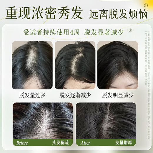 Zolanya Ginger Anti Hair Loss and Hair Firming Wash and Care Set (Anti Hair Loss Shampoo 800ml + Conditioner 800ml) Ginger Hair Firming