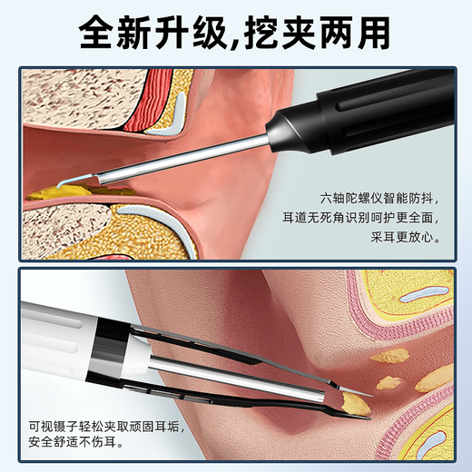 Shantou Lincun Ear Picking Spoon V12Pro HD Visual Ear Picking Spoon with Clip Tweezers Home Ear Picking Artifact for Ear Picking Classic Black V12 Pro comes with 6 silicone earmuffs/no jams