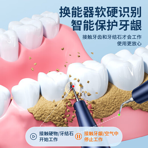 DIKTT German dental scaler ultrasonic cleaning tooth calculus remover smoke stain removal artifact household electric dental scaler teeth cleaning dirt removal tartar gift for the elderly parents and boyfriends Yuanshan Blue - 5-speed adjustment - high frequency ultrasonic - free full set of teeth cleaning gifts easy to use + tooth cleaning gravel does not hurt the teeth