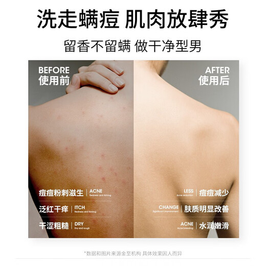 Zunlan anti-mite shower gel for men and women 500g, anti-acne, oil control, anti-itch, long-lasting fragrance, bath moisturizing and moisturizing