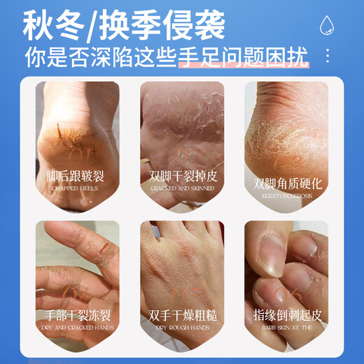 Madeleine Vaseline Double Protective Cream for Chapped Hands and Feet Moisturizer Heel Anti-Crack Moisturizing Moisturizing Cream for Dry Winter Use 40g 1 bottle Vaseline Double Protective Cream