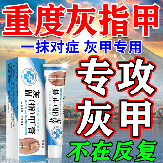 Special effects on onychomycosis. Nail thickening, yellowing, thickening and emptying. Fungal infection. Original imported from Japan. Onychomycosis ointment 1 box. What is the best medicine for onychomycosis in Jingdong store? Quick onychomycosis special large ointment room