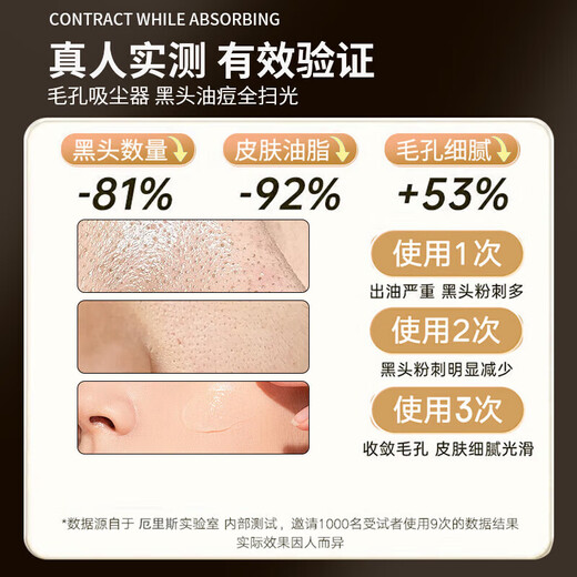 Xiaomi punta artefacto de limpieza de espinillas instrumento para espinillas chupa espinillas y acné limpia los poros instrumento súper succión limpiador de poros limpiador facial limpieza facial doméstica e instrumento de belleza blanco gran poder de succión + movimiento mejorado + algodón, excelente efecto/cinco cabezales de succión