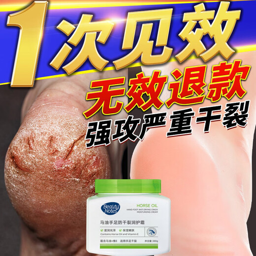 BEAUTY NOTES Horse Oil Anti-Crack Cream Vaseline Cracked Hands, Feet, Cracked Heels, Moisturizing Body Lotion, Hand Cream 380g