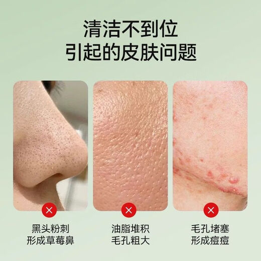 KONKA visual blackhead absorbing instrument cleaner electric blackhead instrument facial pore cleaning acne home beauty instrument tail cargo machine recommended theater same style mobile APP visual cleaning set