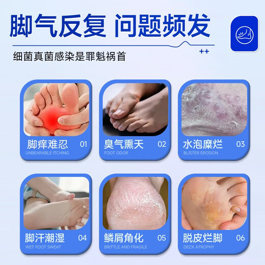 Athlete's foot spray to relieve itching, peeling and rotten feet, fungal infection, deodorizing and root removal, special treatment for smelly and sweaty feet, 3 boxes