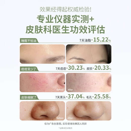 Kangaroo Mom Youth Skin Care Set, Oil Control, Anti-acne, Cleansing Lotion, Three-piece Set for 12-18 Years Old Boys and Girls Adolescent Students